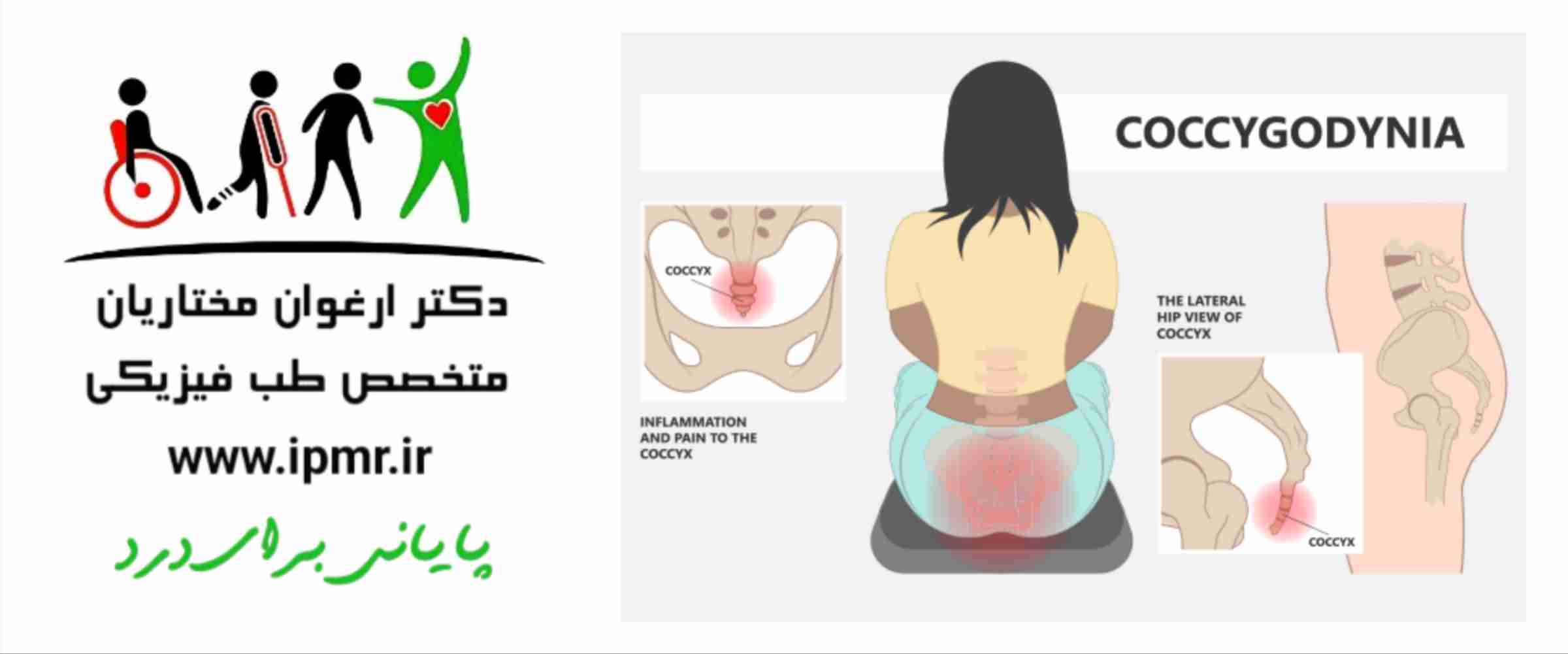 علل درد دنبالچه 