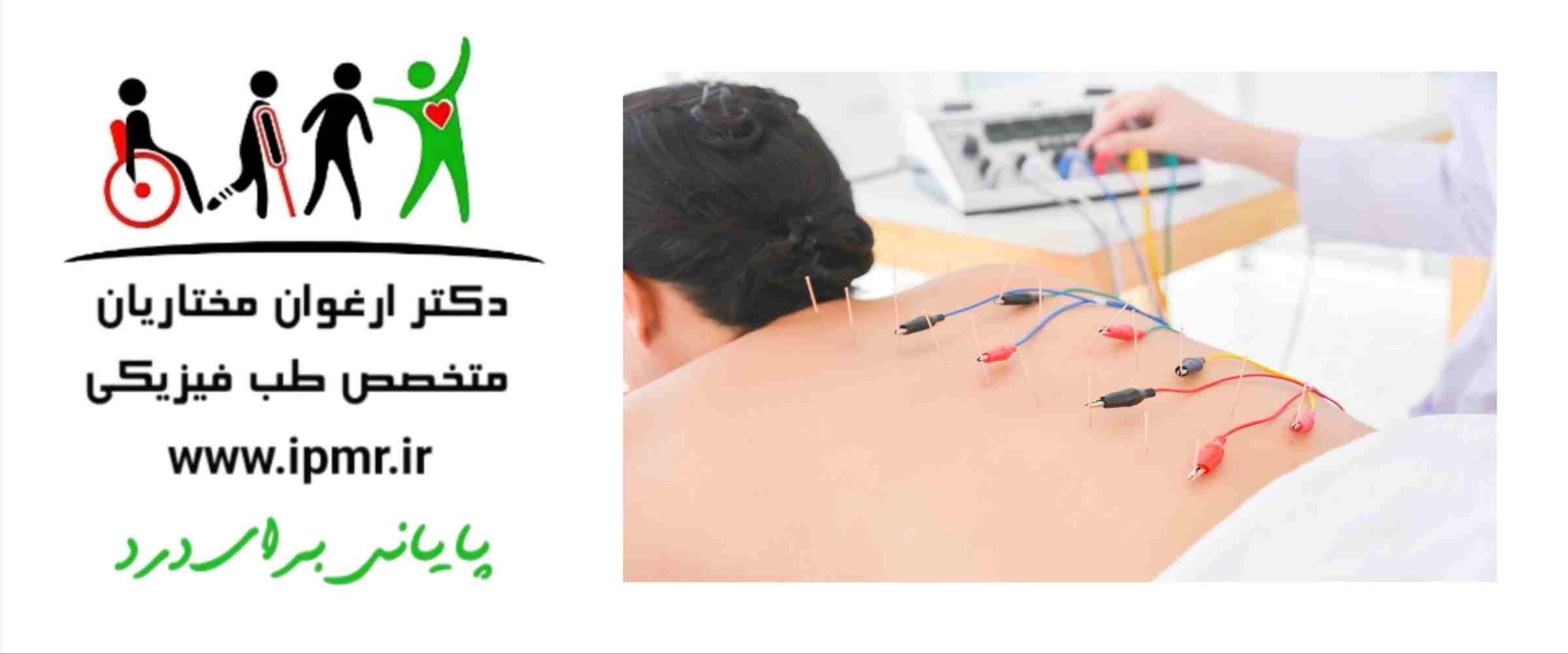 الکترواکوپانکچر برای درمان بیماری های عضلانی اسکلتی
