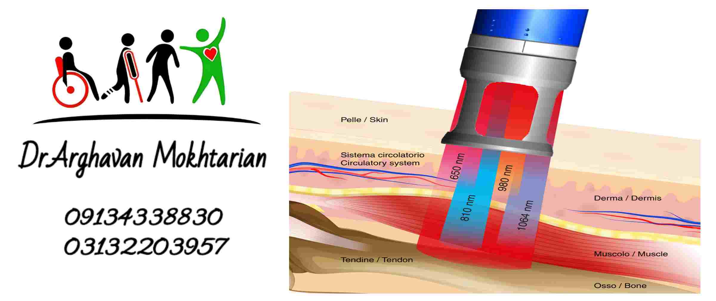 لیزر درمانی پرتوان اصفهان