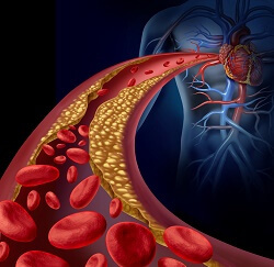 ارتباط مکمل های کلسیمی با افزایش خطر بیماری های قلبی عروقی