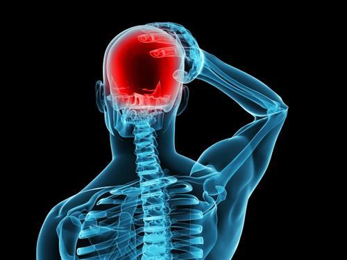 سردرد ناشی از بیماریهای گردن